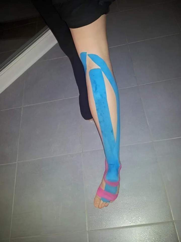 Thérapie K-taping Bois-d'Arcy