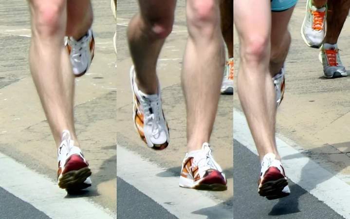 Podologue du sport Bois-d'Arcy